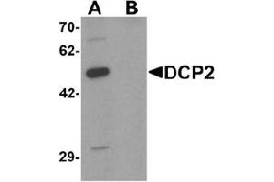 Western blot analysis of DCP2 in 293 cell lysate with DCP2 Antibody  at 1 μg/ml in (A) the absence and (B) the presence of blocking peptide. (DCP2 Antikörper  (C-Term))