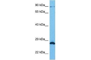 Host:  Rabbit  Target Name:  SUN1  Sample Tissue:  Human HCT116 Whole Cell  Antibody Dilution:  1ug/ml (SUN1 Antikörper  (N-Term))