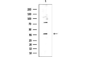anti-Translocase of Outer Mitochondrial Membrane 40 Homolog (TOMM40) (Internal Region) antibody