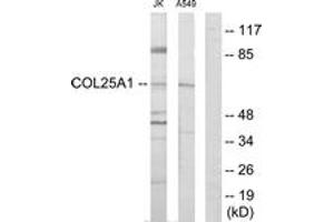 Western Blotting (WB) image for anti-Collagen, Type XXV, alpha 1 (COL25A1) (AA 101-150) antibody (ABIN2889929) (COL25A1 Antikörper  (AA 101-150))