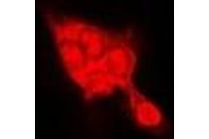 Immunofluorescent analysis of SELENBP1 staining in Hela cells. (SELENBP1 Antikörper)