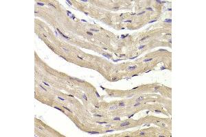 Immunohistochemistry of paraffin-embedded Mouse heart using COPS3 antibody at dilution of 1:100 (x400 lens). (COPS3 Antikörper)