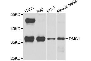 Western blot analysis of extracts of various cell lines, using DMC1 antibody. (DMC1 Antikörper  (AA 1-260))