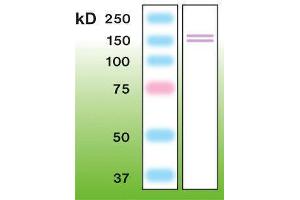 Western Blotting (WB) image for anti-Nitric Oxide Synthase 2, Inducible (NOS2) antibody (ABIN870300) (NOS2 Antikörper)