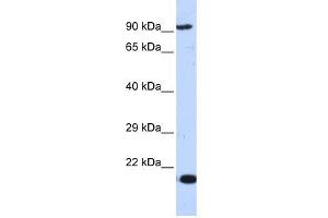 MCM7 antibody used at 1 ug/ml to detect target protein. (MCM7 Antikörper  (Middle Region))