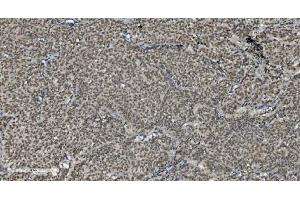 IHC analysis of U2AF65/U2AF2 using anti U2AF65/U2AF2 antibody (ABIN7600795).