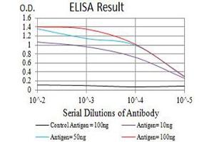 Black line: Control Antigen (100 ng),Purple line: Antigen (10 ng), Blue line: Antigen (50 ng), Red line:Antigen (100 ng)