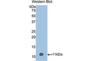 Western blot analysis of the recombinant protein. (Vitamin D-Binding Protein Antikörper  (AA 395-473))