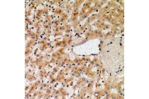 Immunohistochemical analysis of NOX1 staining in human liver formalin fixed paraffin embedded tissue section. (NOX1 Antikörper)