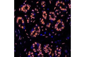 Immunofluorescence (IF) image for anti-Structural Maintenance of Chromosomes 1A (SMC1A) (C-Term) antibody (ABIN7455193) (Rekombinanter SMC1A Antikörper  (C-Term))