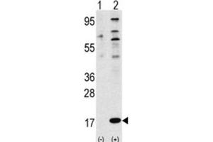Western Blotting (WB) image for anti-Finkel-Biskis-Reilly Murine Sarcoma Virus (FBR-MuSV) Ubiquitously Expressed (FAU) antibody (ABIN2998455) (FAU Antikörper)