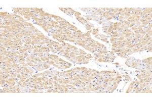 Immunohistochemistry (IHC) image for anti-Fatty Acid Binding Protein 3, Muscle and Heart (FABP3) (AA 1-133) antibody (ABIN7443005)