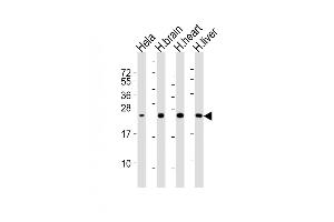 All lanes : Anti-SD Antibody at 1:2000 dilution Lane 1: Hela whole cell lysates Lane 2: human brain lysates Lane 3: human heart lysates Lane 4: human liver lysates Lysates/proteins at 20 μg per lane. (SOD2 Antikörper)