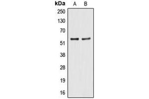 Western blot analysis of ALDH2 expression in HegG2 (A), A549 (B) whole cell lysates. (ALDH2 Antikörper  (N-Term))
