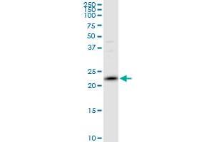 PRDX2 MaxPab polyclonal antibody. (Peroxiredoxin 2 Antikörper  (AA 1-198))