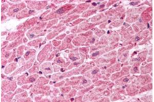 Human Heart (formalin-fixed, paraffin-embedded) stained with TICAM1 antibody ABIN457458 at 10 ug/ml followed by biotinylated goat anti-rabbit IgG secondary antibody ABIN481713, alkaline phosphatase-streptavidin and chromogen. (TICAM1 Antikörper  (C-Term))