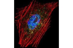 Immunofluorescence (IF) image for anti-Parkinson Protein 2, E3 Ubiquitin Protein Ligase (Parkin) (PARK2) antibody (ABIN3002635) (Parkin Antikörper)