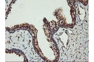 Image no. 8 for anti-V-Akt Murine Thymoma Viral Oncogene Homolog 1 (AKT1) antibody (ABIN1496554) (AKT1 Antikörper)