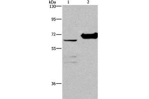 Western Blot analysis of 231 cell and Mouse kidney tissue using CHDH Polyclonal Antibody at dilution of 1:400 (CHDH Antikörper)