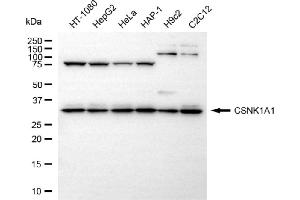 Western blotting analysis using CSNK1A1 antibody (ABIN7797880). (Rekombinanter CSNK1A1 Antikörper)