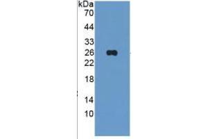 WB of Protein Standard: different control antibodies  against Highly purified E. (TIE1 ELISA Kit)