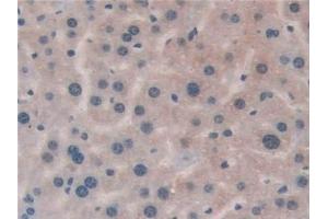 Immunohistochemistry (IHC) image for anti-Major Histocompatibility Complex, Class II, DR beta 1 (HLA-DRB1) (AA 27-264) antibody (ABIN7440767)