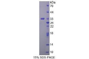 SDS-PAGE (SDS) image for Trehalase (Brush-Border Membrane Glycoprotein) (TREH) (AA 151-411) protein (His tag) (ABIN1878715) (TREH Protein (AA 151-411) (His tag))