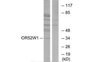 Western blot analysis of extracts from HeLa cells, using OR52W1 Antibody. (OR52W1 Antikörper  (AA 271-320))