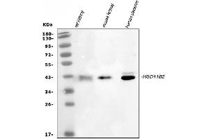 Western blot analysis of HSD11B2 using anti-HSD11B2 antibody (ABIN3043846). (HSD11B2 Antikörper  (C-Term))