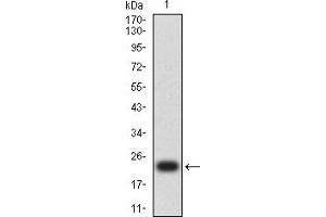 Western blot analysis using HIF2a mAb against human HIF2a (AA: 680-870) recombinant protein. (EPAS1 Antikörper  (AA 680-870))