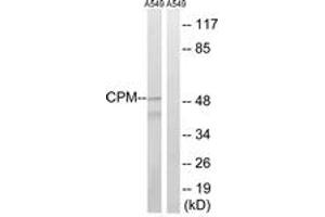 Western Blotting (WB) image for anti-Carboxypeptidase M (CPM) (AA 71-120) antibody (ABIN2890194) (CPM Antikörper  (AA 71-120))