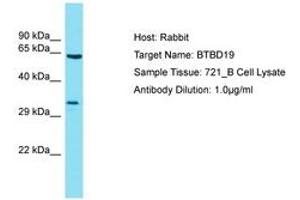 Image no. 1 for anti-BTB (POZ) Domain Containing 19 (BTBD19) (AA 208-257) antibody (ABIN6750766) (BTBD19 Antikörper  (AA 208-257))