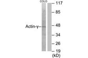 Western blot analysis of extracts from COLO205 cells, using Actin-gamma2 Antibody. (ACTG2 Antikörper  (AA 1-50))