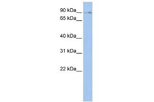 WB Suggested Anti-BMP2K Antibody Titration:  0. (BMP2K Antikörper  (Middle Region))
