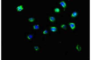 Immunofluorescence staining of A549 cells with ABIN7157528 at 1:200, counter-stained with DAPI.
