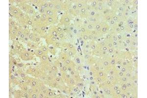 Immunohistochemistry of paraffin-embedded human liver tissue using ABIN7170690 at dilution of 1:100 (Stanniocalcin 1 Antikörper  (AA 18-247))