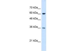 Western Blotting (WB) image for anti-Stress-Induced-phosphoprotein 1 (STIP1) antibody (ABIN2462950) (STIP1 Antikörper)