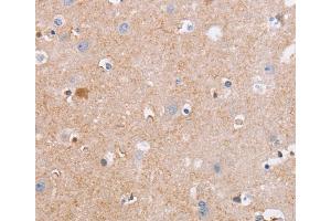 Immunohistochemistry (IHC) image for anti-Cell Division Cycle 7 (CDC7) antibody (ABIN2434442)