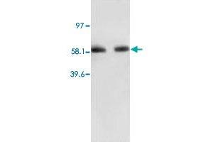 Western Blot analysis of RELA expression from human colon carcinoma lyate with RELA polyclonal antibody . (NF-kB p65 Antikörper  (N-Term))