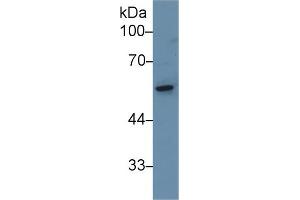 Western Blot; Sample: Rat Small intestine lysate; Primary Ab: 1µg/ml Rabbit Anti-Rat KRT8 Antibody Second Ab: 0. (CAP1 Antikörper  (AA 38-149))