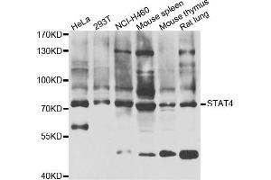 Western blot analysis of extracts of various cell lines, using STAT4 antibody. (STAT4 Antikörper)