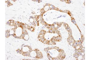 Immunohistochemistry (IHC) image for anti-Dihydrolipoamide S-Succinyltransferase (E2 Component of 2-Oxo-Glutarate Complex) (DLST) (AA 50-100) antibody (ABIN7455019) (DLST Antikörper  (AA 50-100))