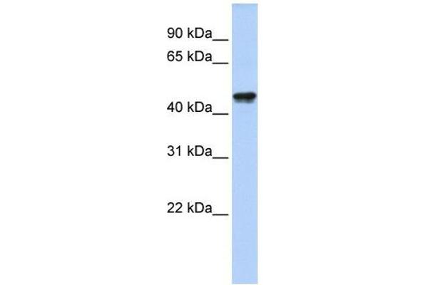 QTRTD1 Antikörper  (N-Term)