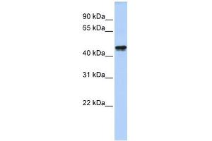 QTRTD1 antibody used at 1 ug/ml to detect target protein. (QTRTD1 Antikörper  (N-Term))