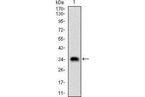 Fig. (CSNK2B Antikörper  (AA 1-215))