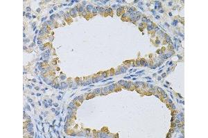 Immunohistochemistry of paraffin-embedded Mouse lung using AP2B1 Polyclonal Antibody at dilution of 1:100 (40x lens). (AP2B1 Antikörper)