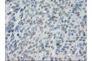 Image no. 1 for anti-Fc gamma RII (CD32) antibody (ABIN1497254) (Fc gamma RII (CD32) Antikörper)