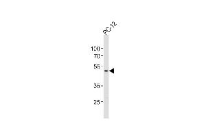 Anti-PIP4K2A Antibody (C-term)at 1:1000 dilution + PC-12 whole cell lysates Lysates/proteins at 20 μg per lane. (PIP4K2A Antikörper  (C-Term))