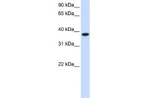 WB Suggested Anti-GLT8D2 Antibody Titration:  0. (GLT8D2 Antikörper  (C-Term))