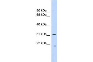 WB Suggested Anti-CAPNS1 Antibody Titration: 0. (Calpain S1 Antikörper  (Middle Region))